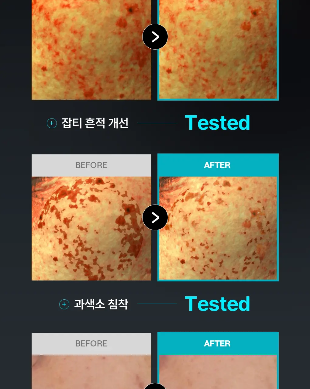 [76관왕 No.1] 메디힐 더마 패드 100매 7종 피부 고민별 골라담기 상세페이지 14